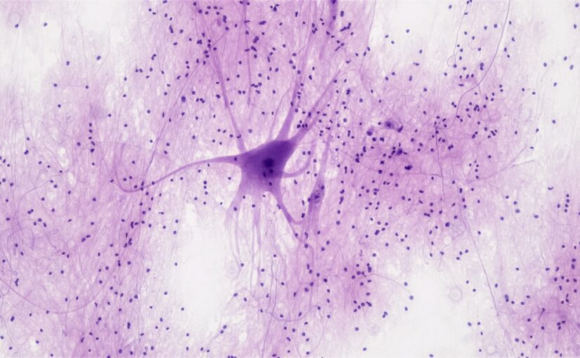 Biomarker Kutatások És Neuroképalkotó Vizsgálatok
