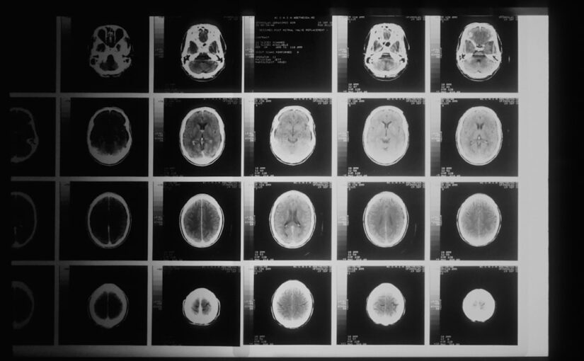 ADHD Uloga Neuroimaginga U Istraživanjima
