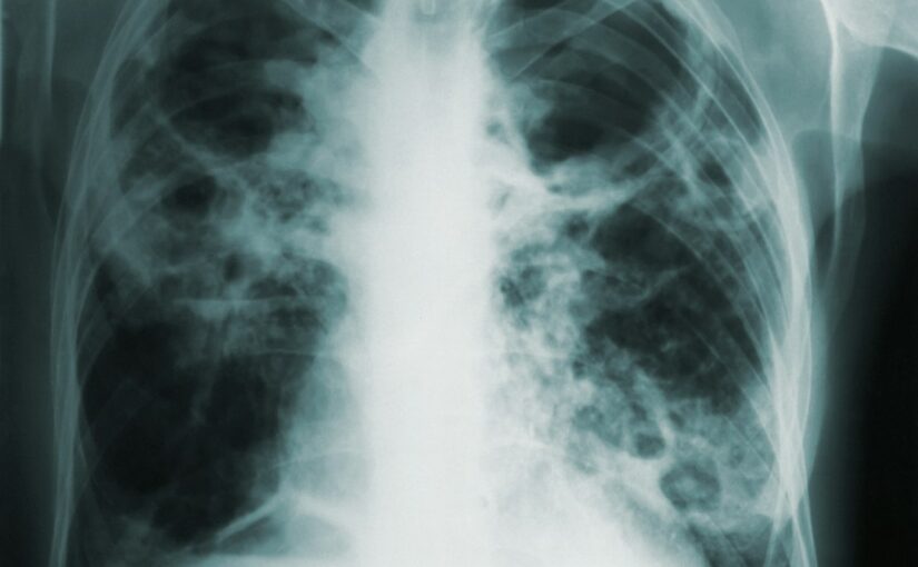 Differentialdiagnostik Bei Verdacht Auf Autismus