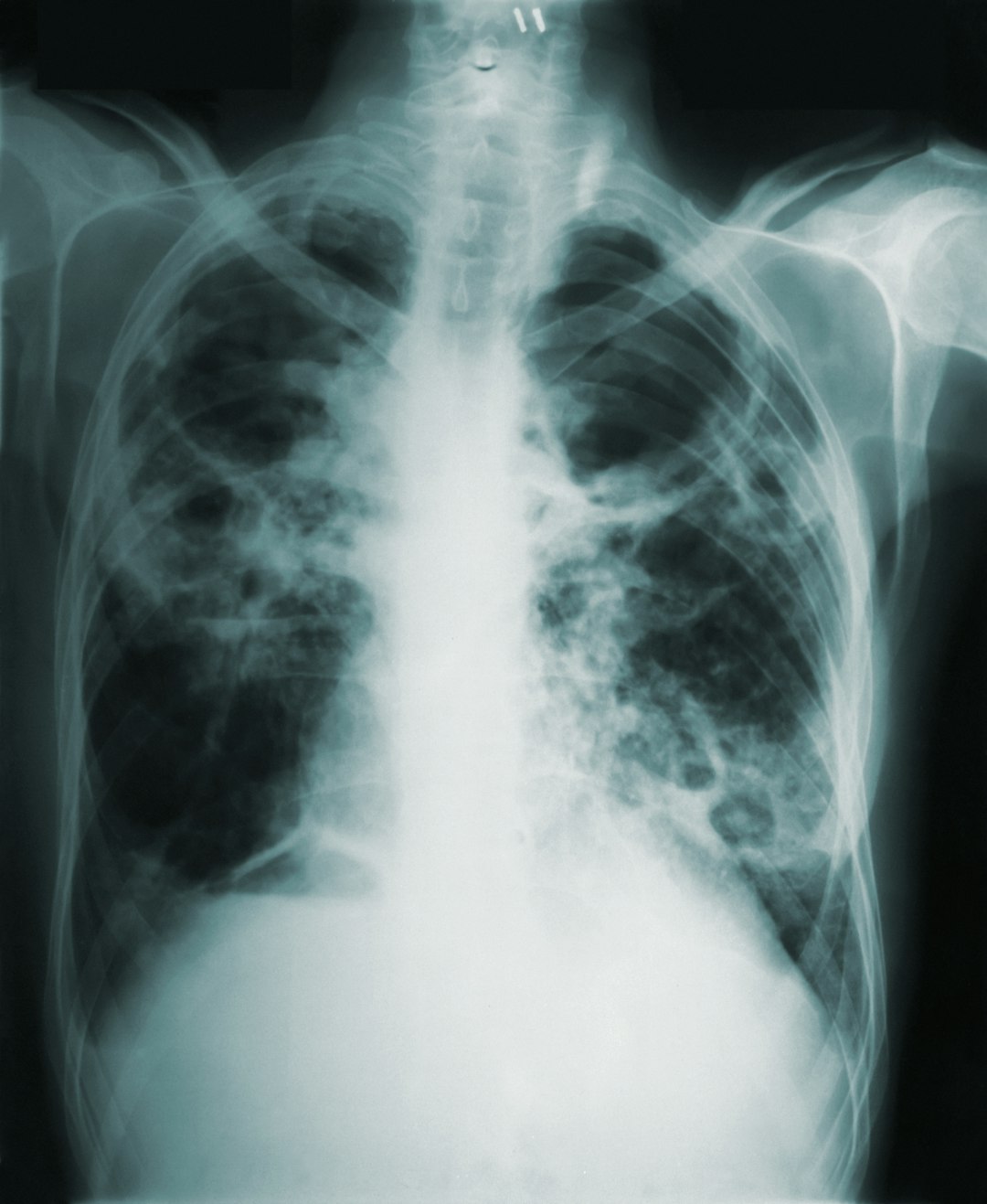 Differentialdiagnostik Bei Verdacht Auf Autismus