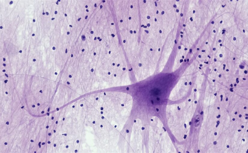 Mécanismes De Plasticité Neuronale Dans L’Autisme