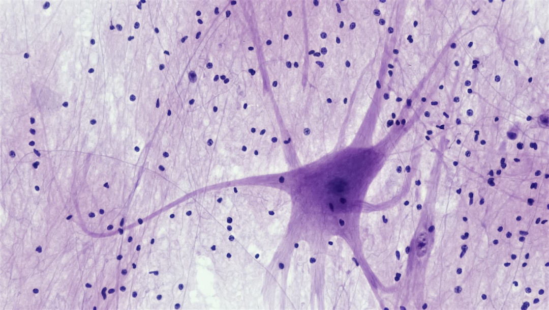 Mécanismes De Plasticité Neuronale Dans L'Autisme