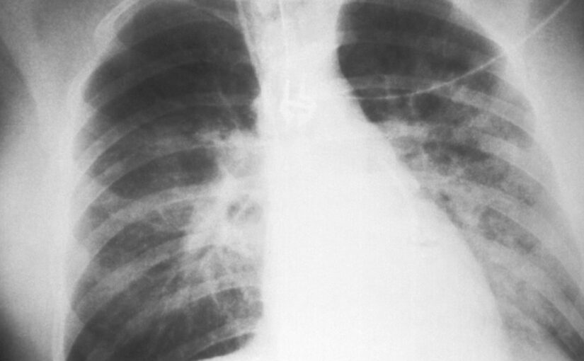 Overgang Fra Børne Til Voksen Diagnoseprocesser
